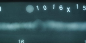 請大家看看這是未熔合還是裂紋