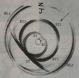 超聲波入射達到圓柱孔后的個種回波
