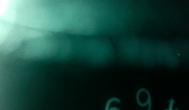 這張咬邊圖大家討論下