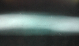 這次RTII考試實習(xí)的時候看的兩張片子，請各位老師講解一下