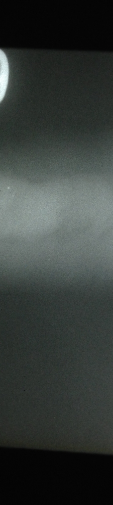 請各位幫助分析一下是什么樣的缺陷？