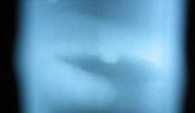 小徑管焊口缺陷