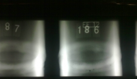 考試復習缺陷底片