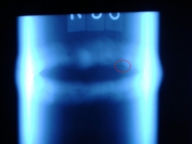 該底片如何評定？